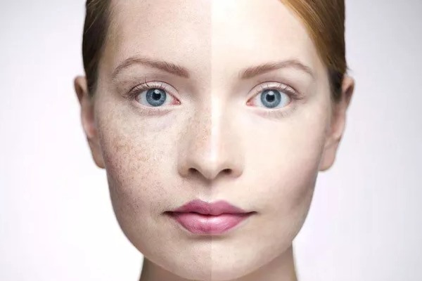 用了去痘去斑霜為什么不見(jiàn)好啊?臉上有痘也有斑,用了好多化妝品都不管事……苦?