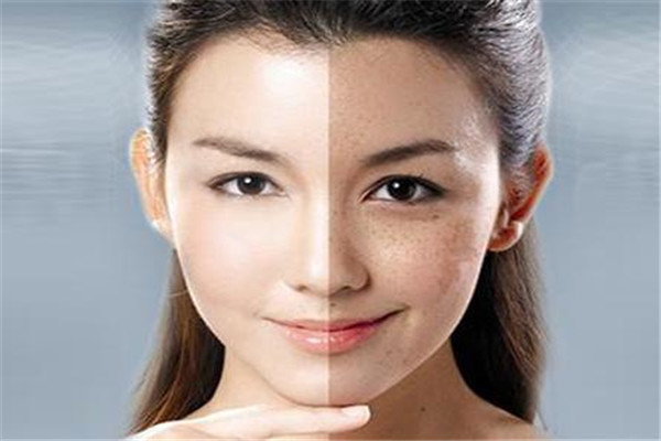 專業(yè)祛斑祛痘店效果怎樣(專業(yè)祛斑祛痘店:效果如何)?